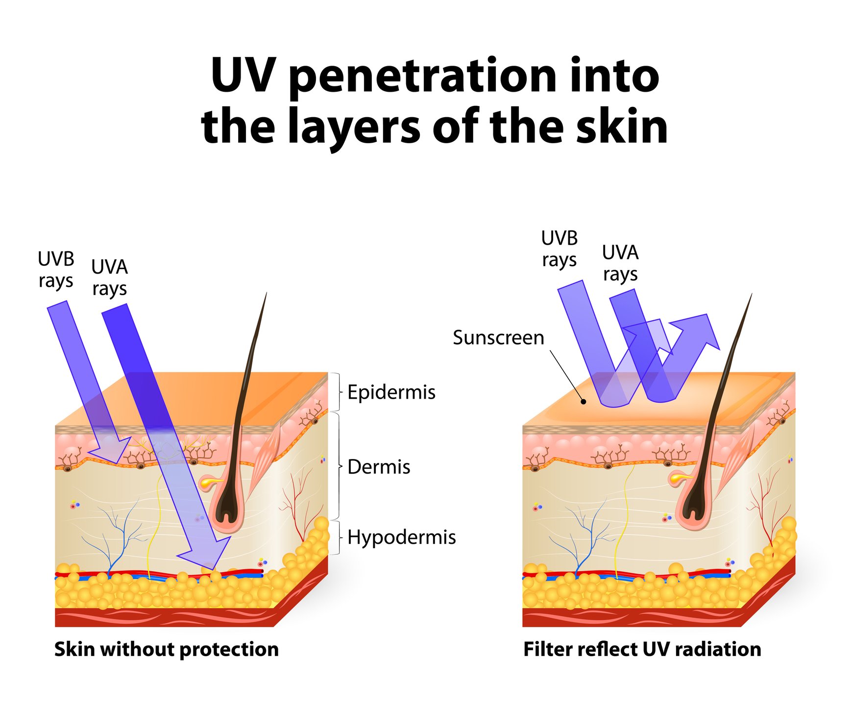 UV Safety Awareness