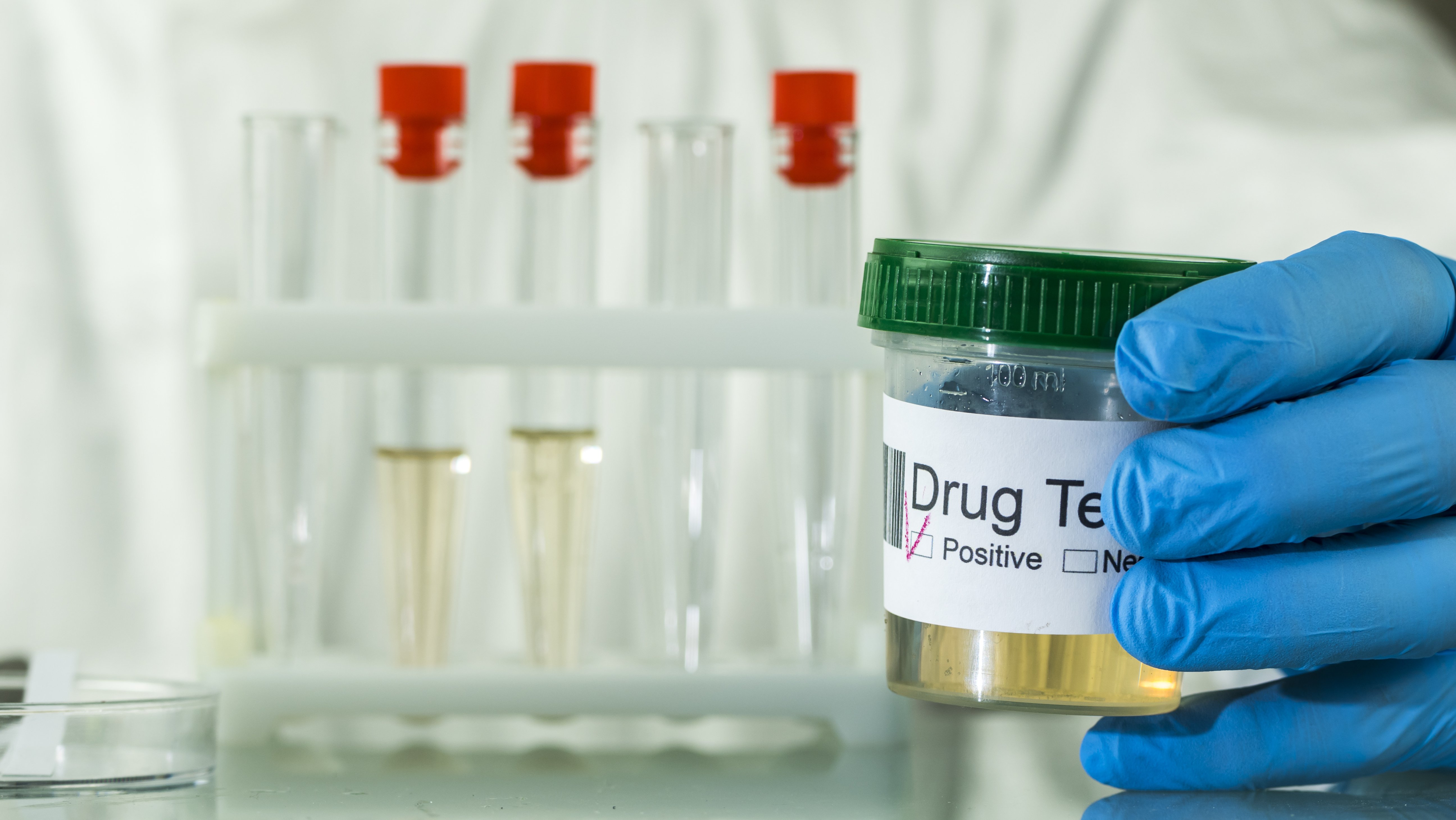 drug testing